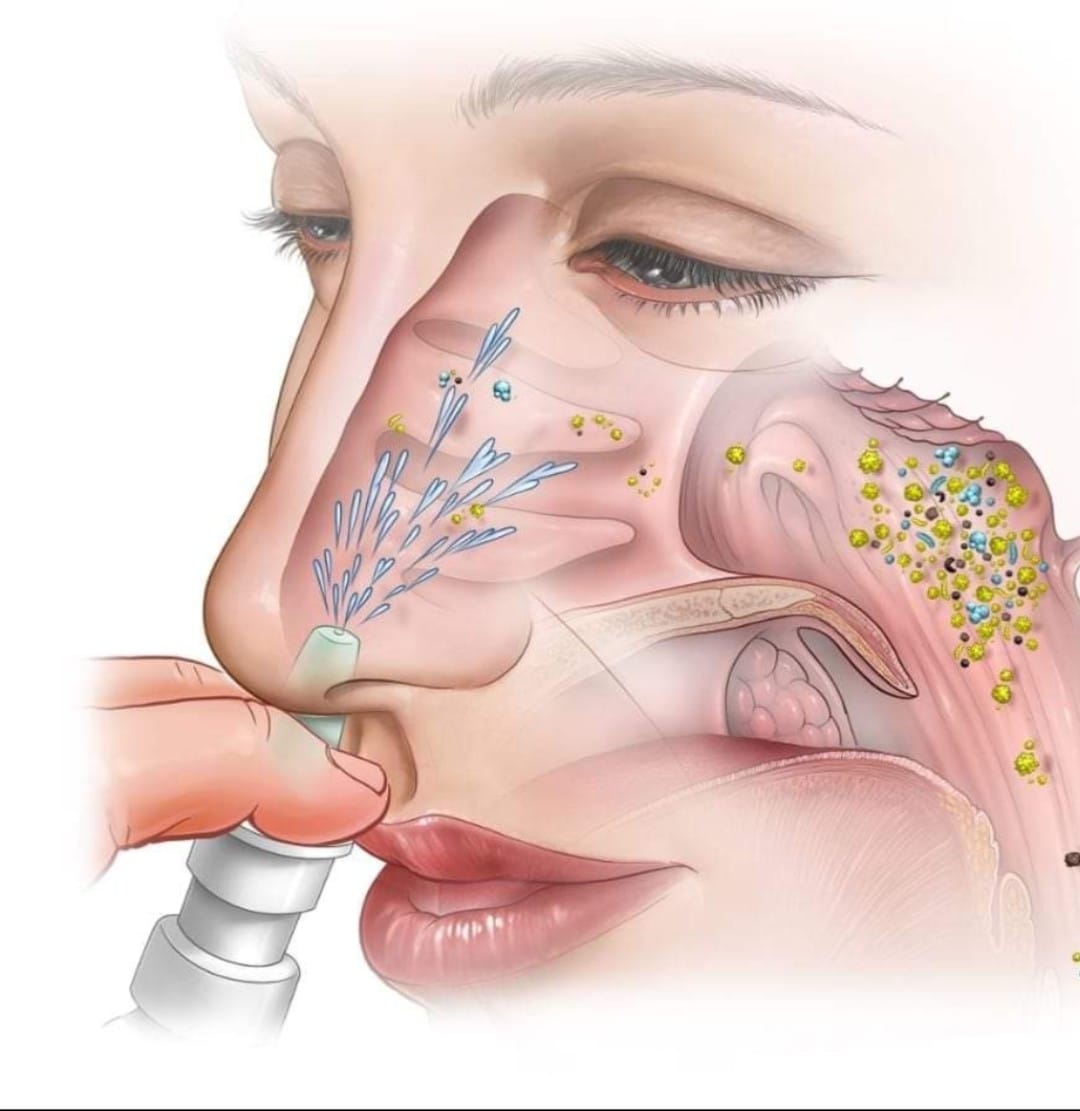 Kapi za sinuse - Sinusitis STOP