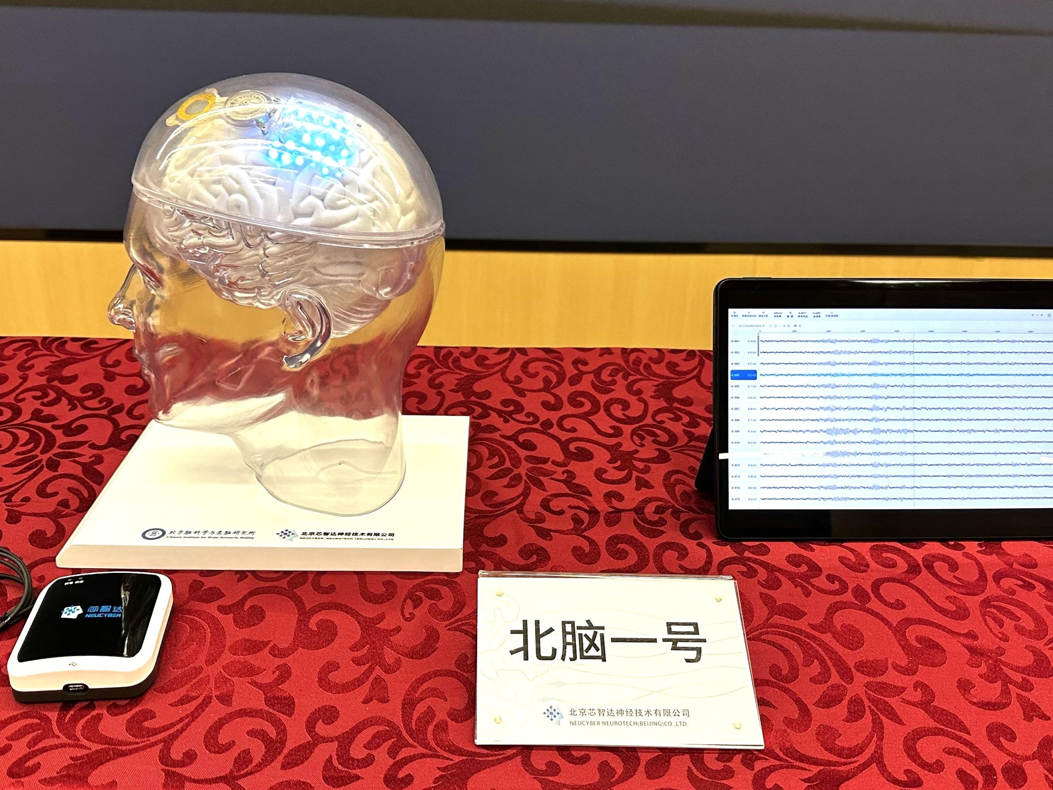 China Daily - A patient who sustained aphasia due to... | Facebook