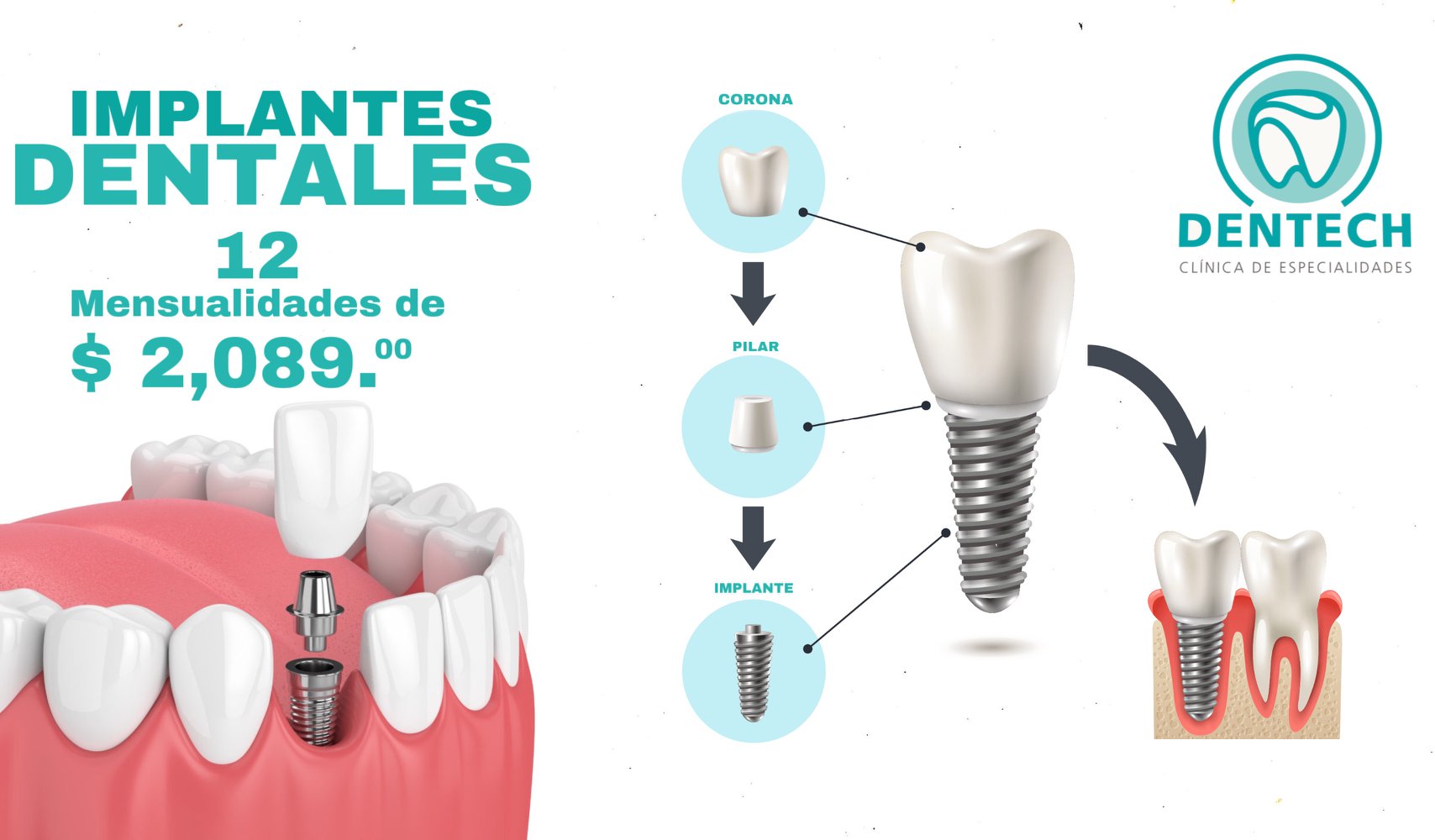 Dentech Clínica de Especialidades