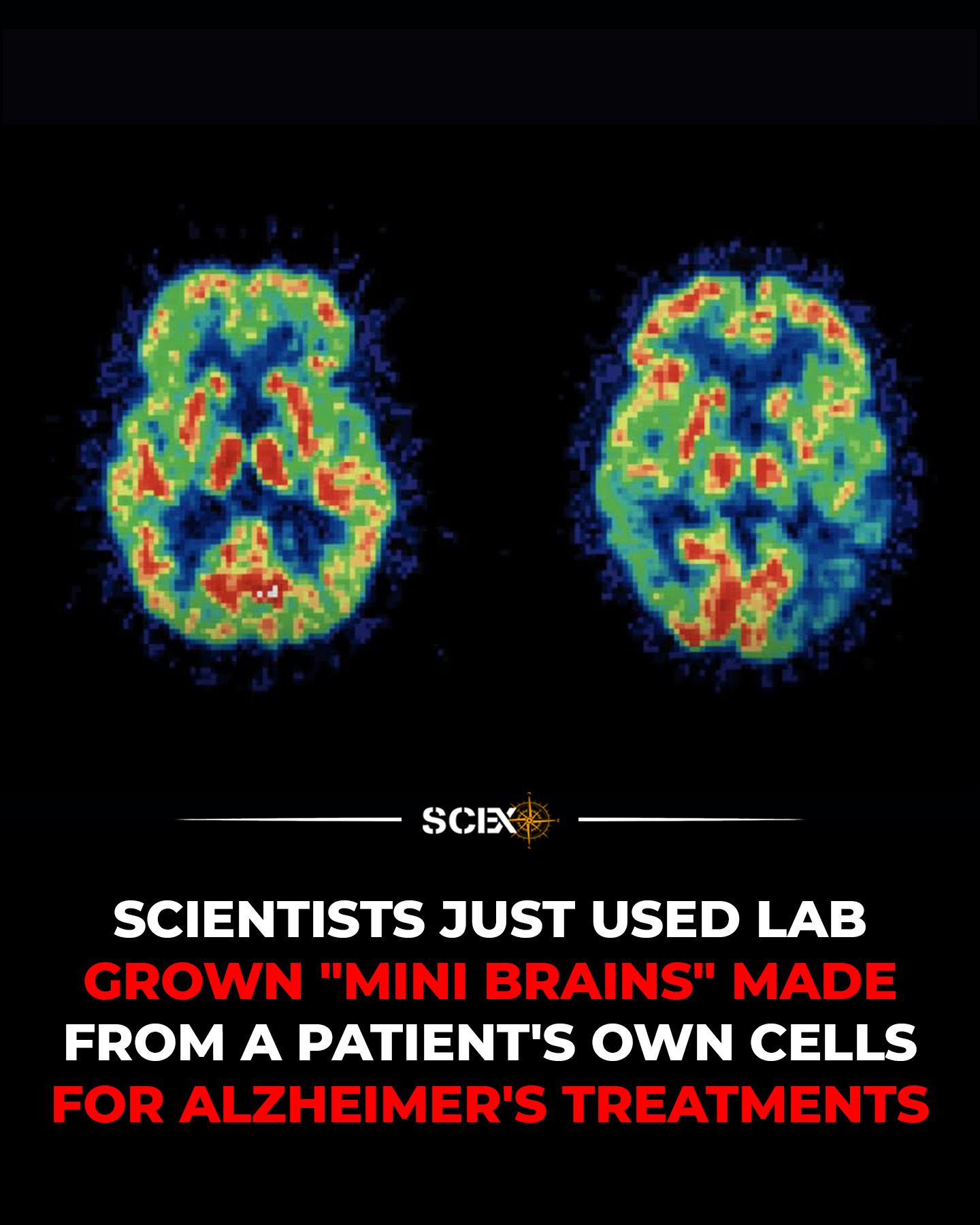 メイク・ザット・チェンジ Scientists have grown personalized “mini-brains” from the blood