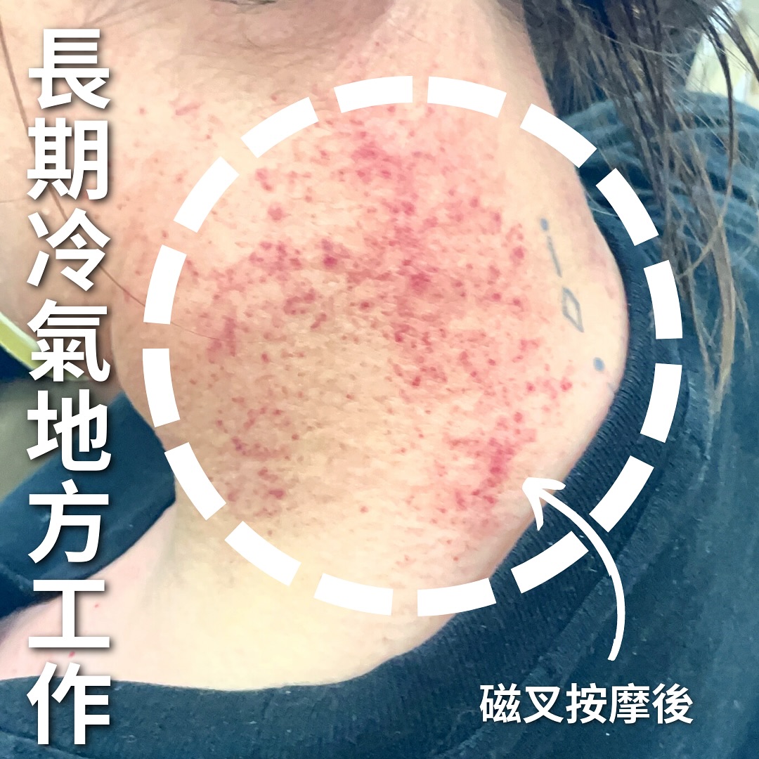磁叉經絡排酸棒 Magnetic Massager | Hong Kong Hong Kong