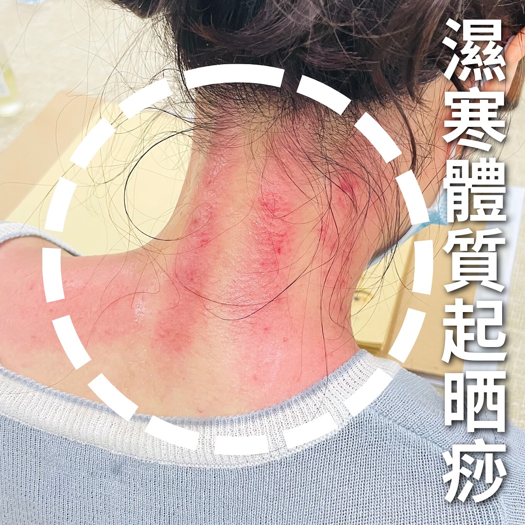 磁叉經絡排酸棒 Magnetic Massager | Hong Kong Hong Kong