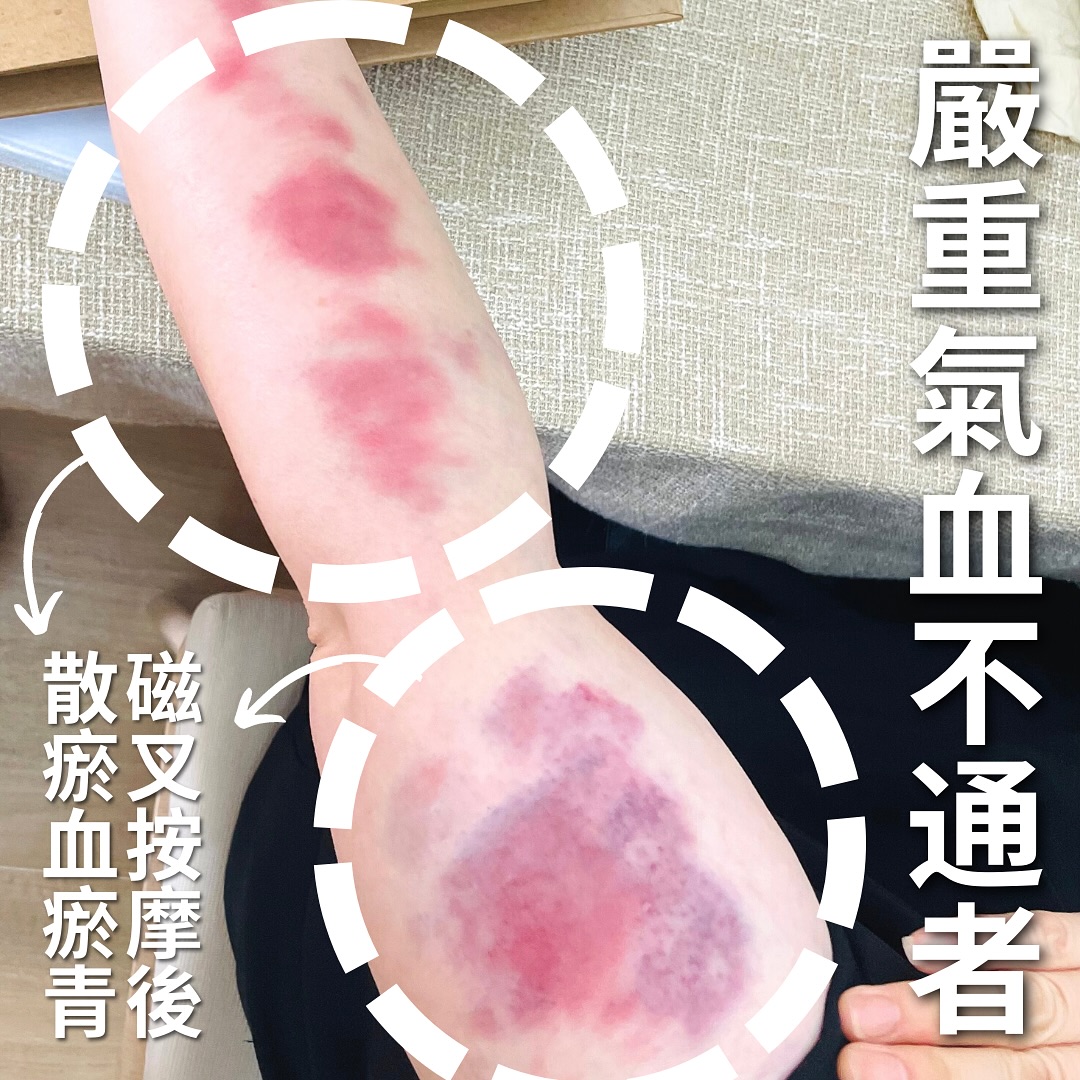 磁叉經絡排酸棒 Magnetic Massager | Hong Kong Hong Kong