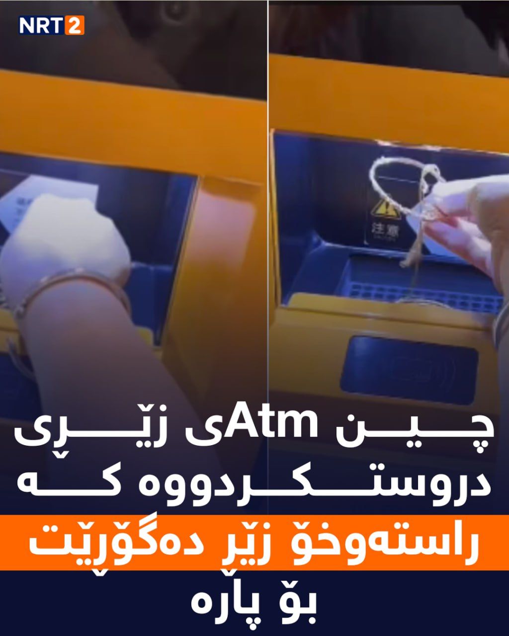 Nrt2 Live Tv ئایا لێدانی هێلکە بۆ قژ سوودی