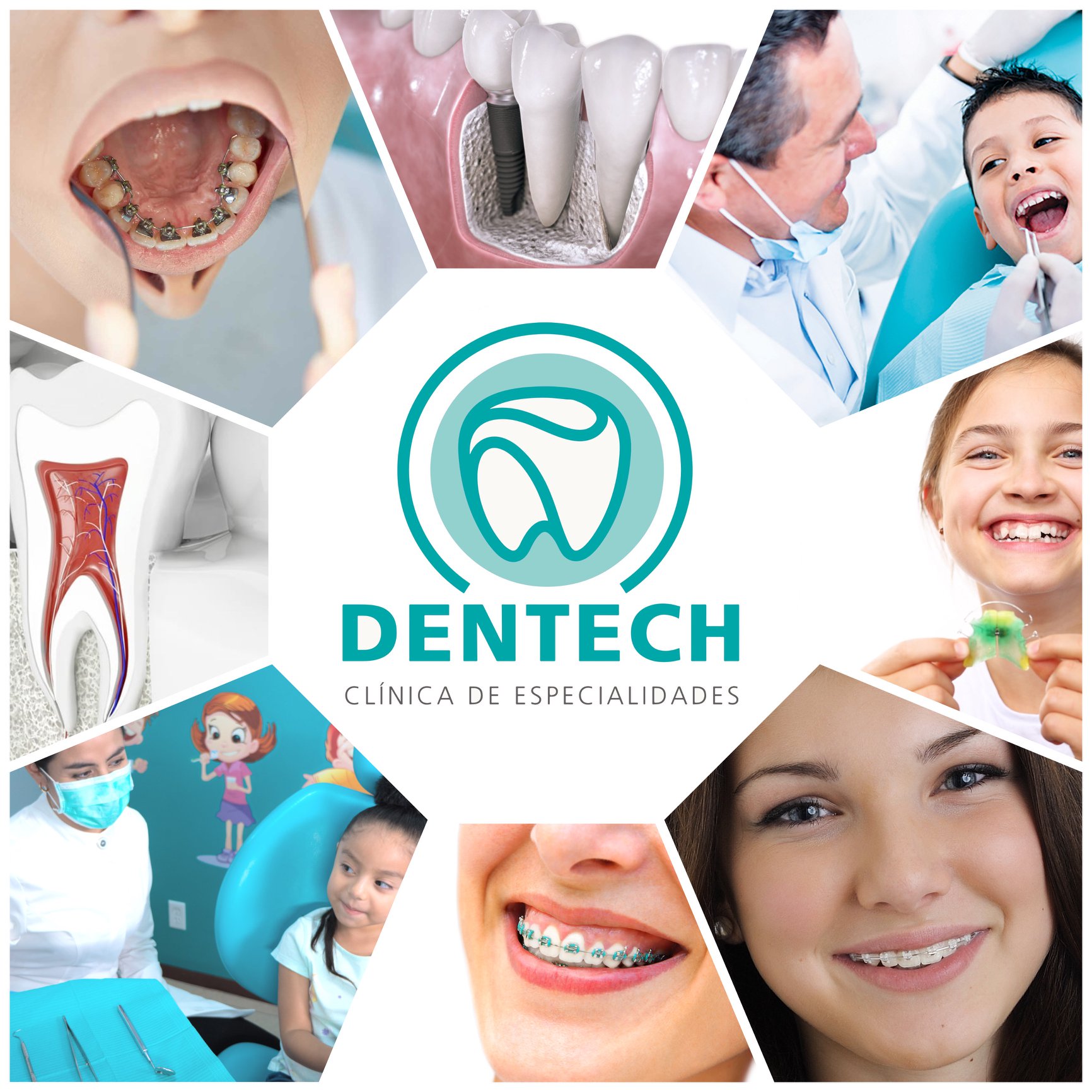Dentech Clínica de Especialidades