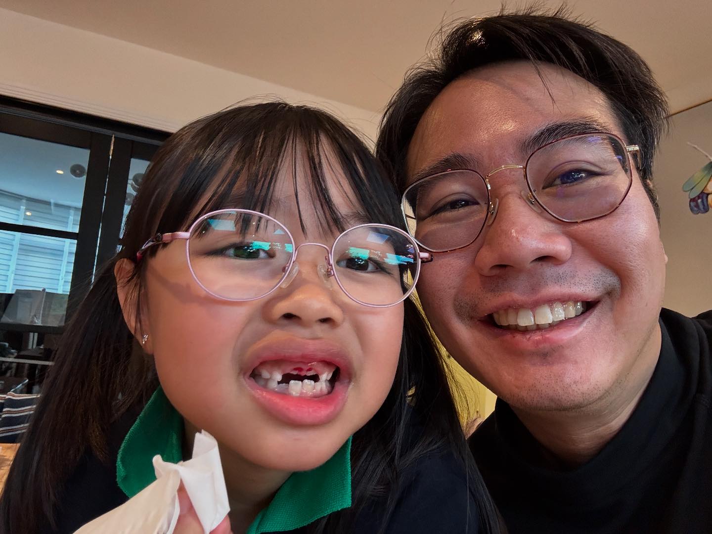 CoCo哥 - 今日有剝咗兩隻大牙🦷🦷大個囡啦 | Facebook