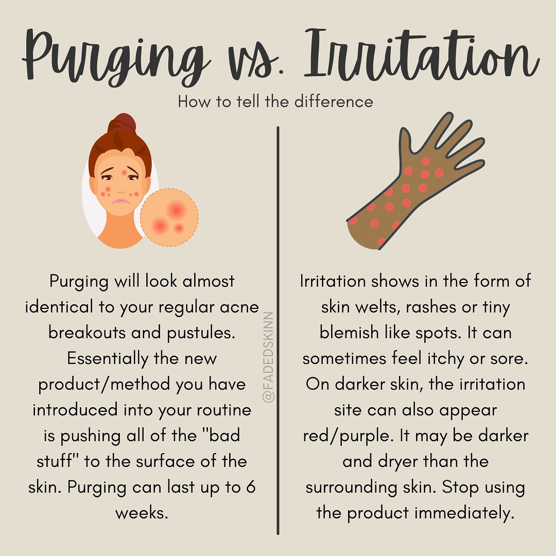Faded Skin - Heres how to tell the difference between skin...