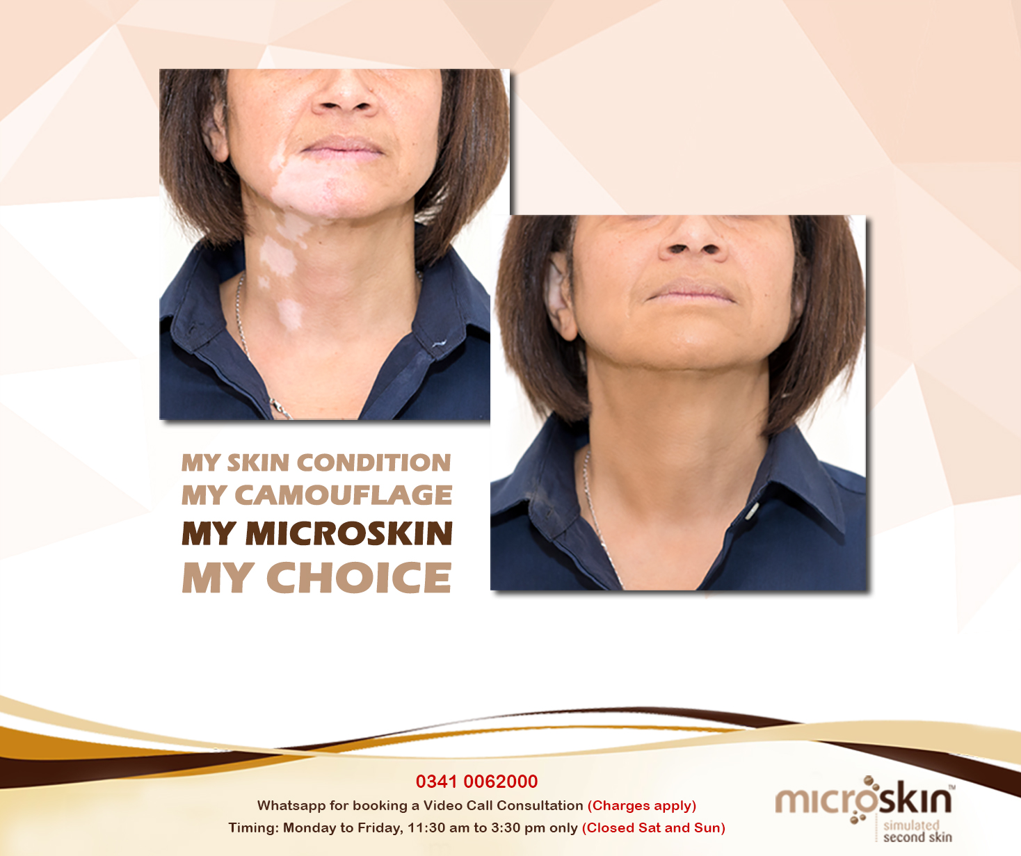 Microskin Pakistan | Karachi