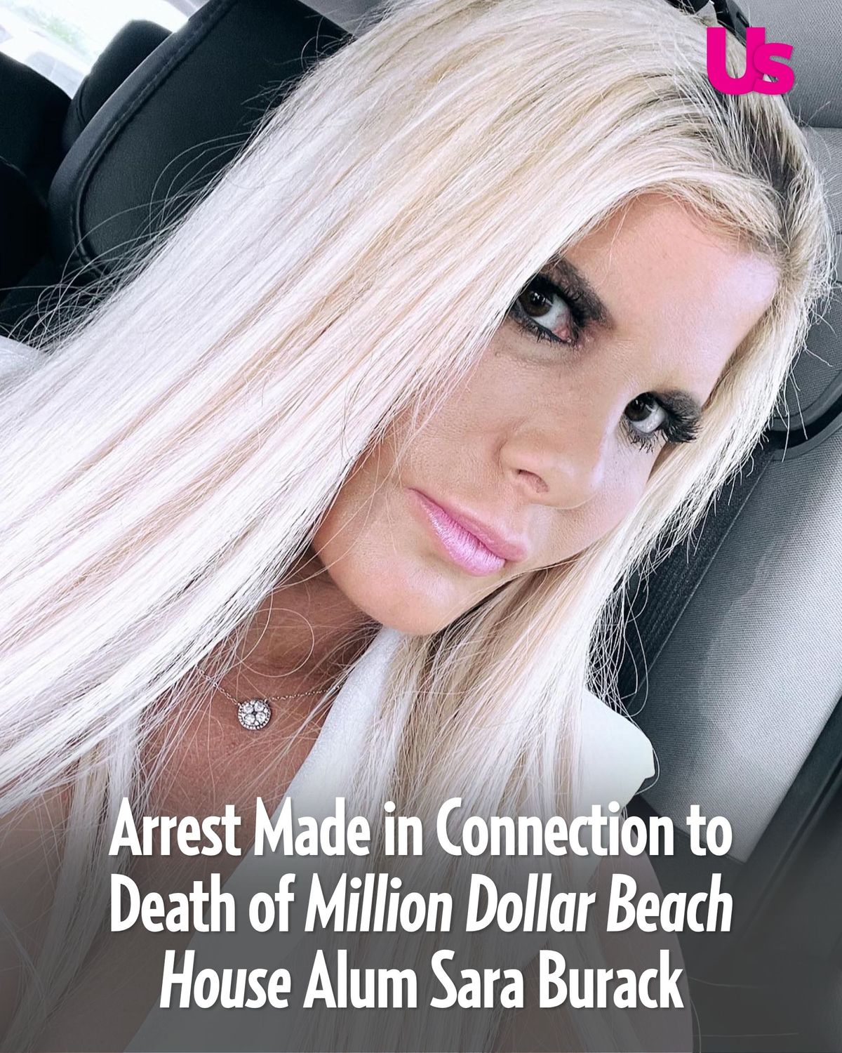 sara burack face plastic surgery net worth Image 7