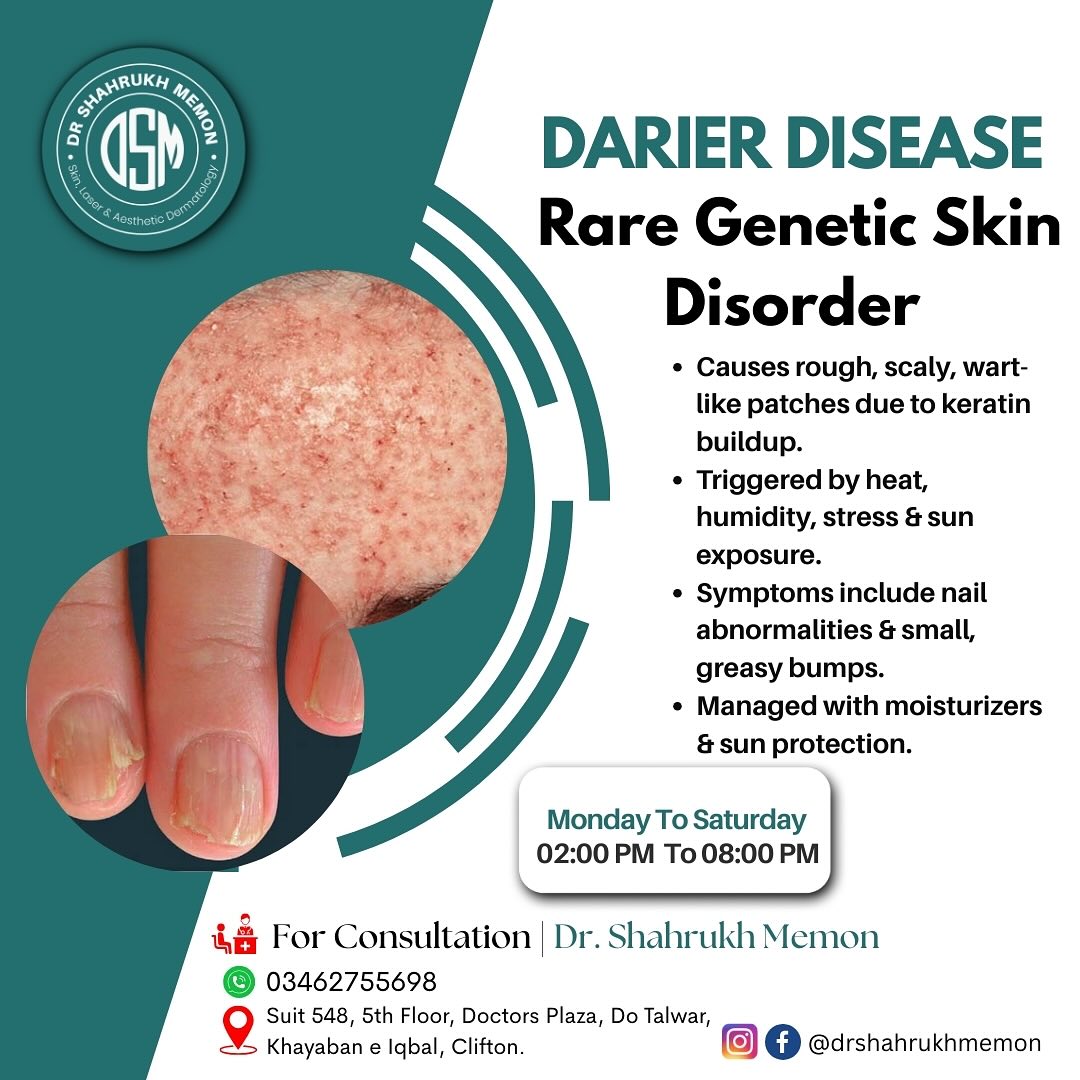 Dr - Darier Disease – Rare Genetic Skin Disorder 1️⃣ Causes rough ...