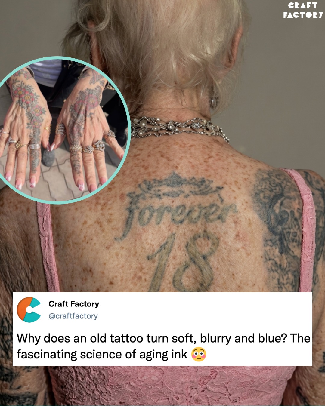 does glutathione fade tattoos Whats Up With White Ink Tattoos? How About White Ink Over Blackout Tattoos? does glutathione fade tattoos Laser