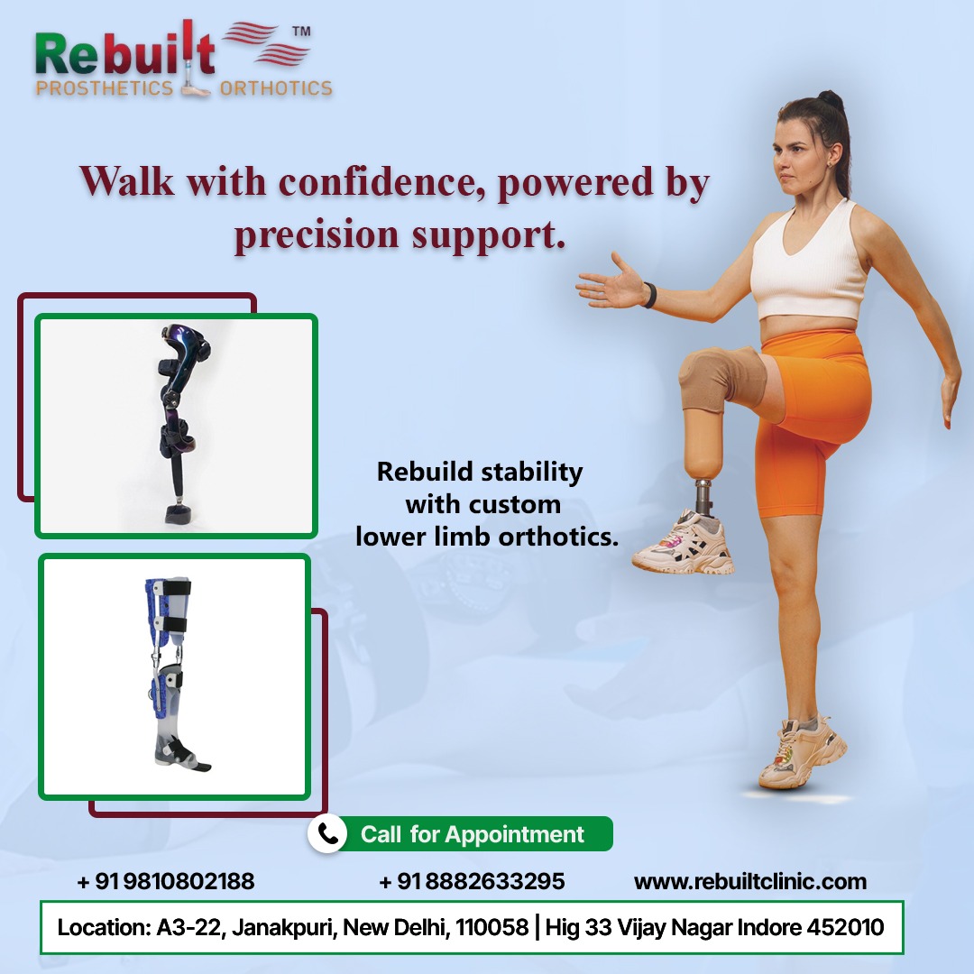 Rebuilt - Upper Limb Prosthetics Manufacturer and suppliers. The world ...