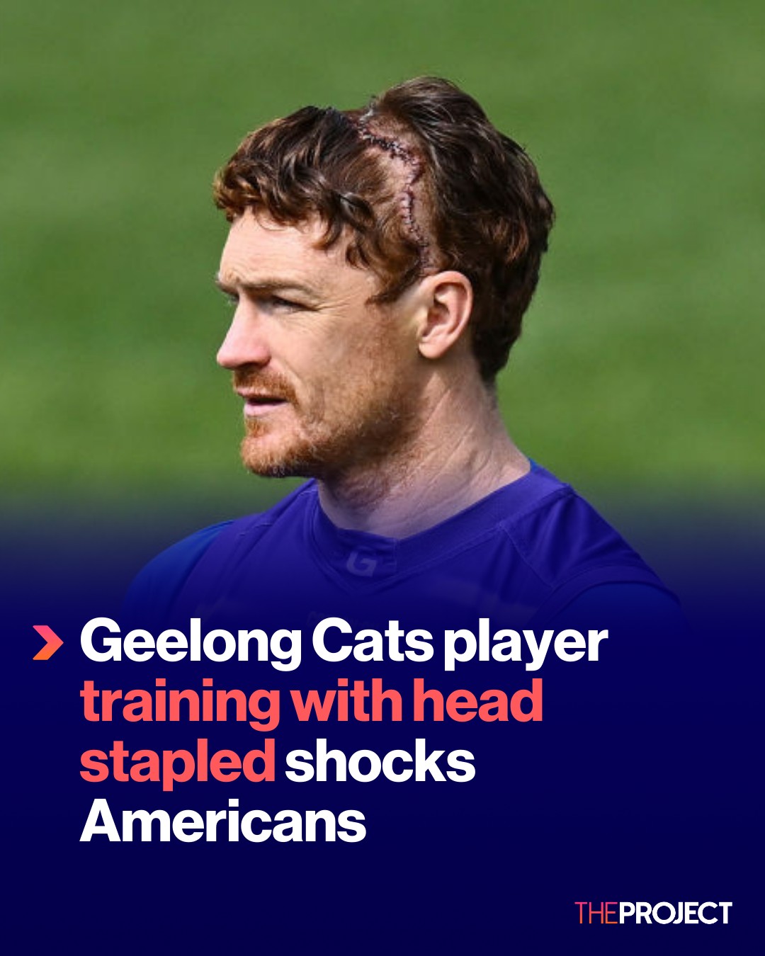 The Project - Veteran Geelong Cats player Gary Rohan was... | Facebook
