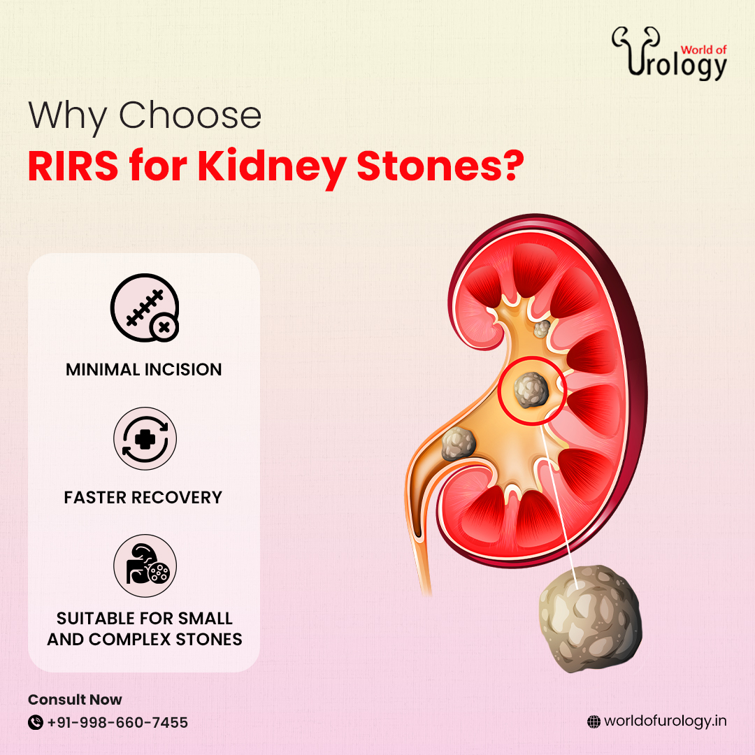 Did you know RIRS is revolutionizing... - World-of-Urology | Facebook