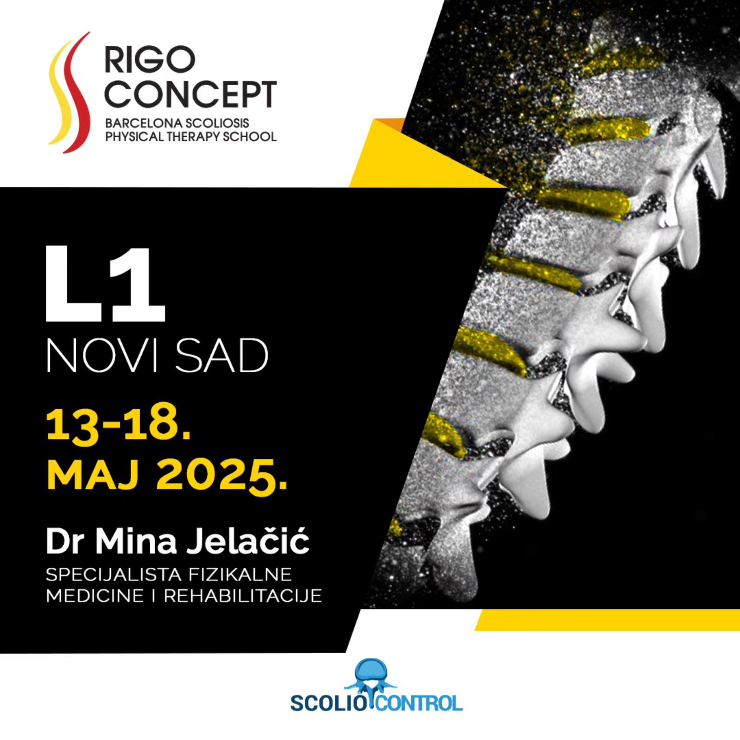 ScolioControl | Novi Sad