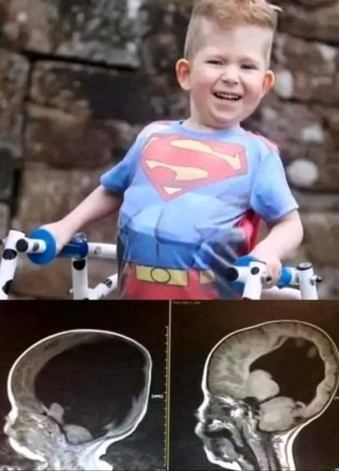 VenusPets: - Meet Noah, a true 