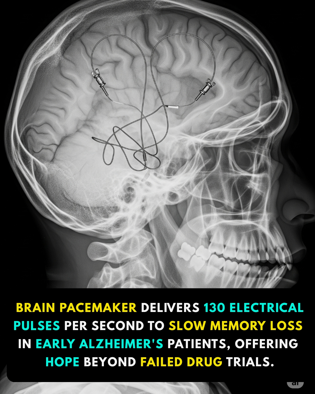 Music - Johns Hopkins Medicine is testing an innovative approach to ...
