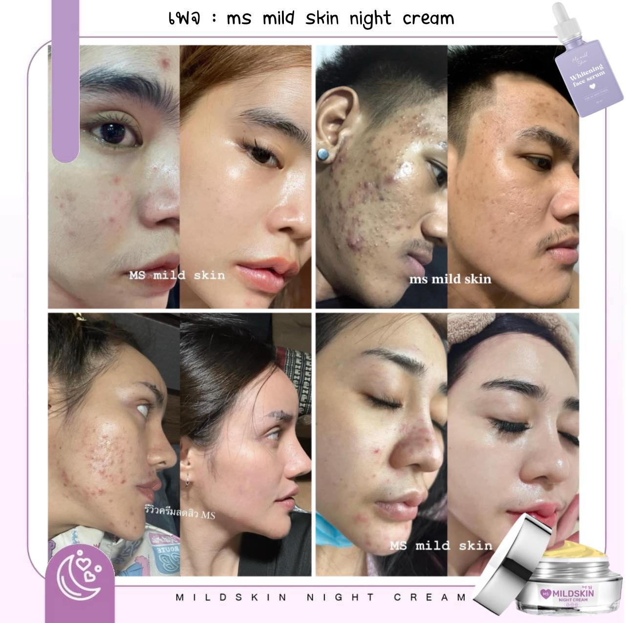 แพคเกตไหนก็ใช้ดี 🥣... - MS mild skin night cream