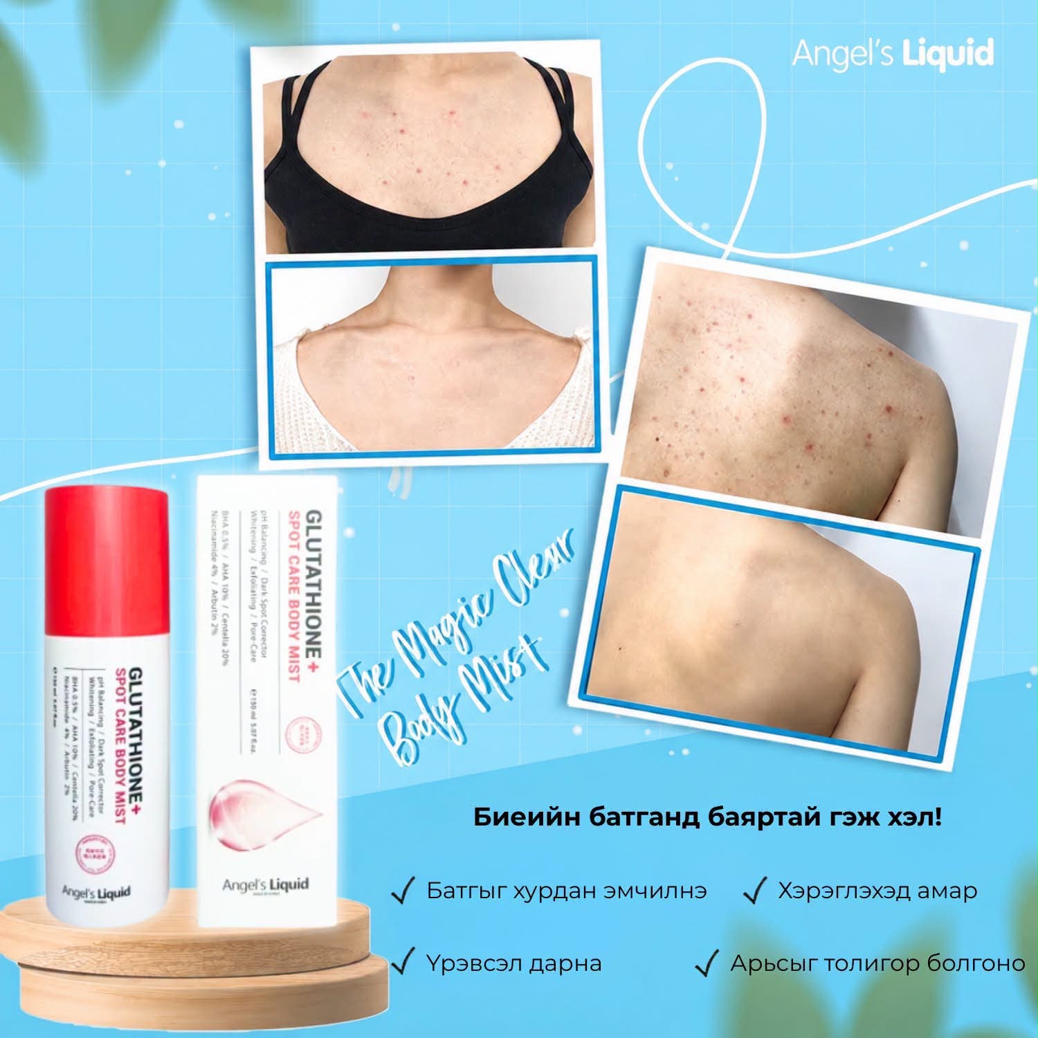 angel's liquid glutathione body mist ✨Angel's + Spot Care Биеийн батга болон нөсөө толбоноос салах алдартай шийдэл! Зун болон өвлийн аль ч улиралд нуруу, цээж, гар болон биеийн бусад хэсгээр үүссэн батга болон launched with the goal Fast Size:10x30ml Bacteriostatic Water for Peptide