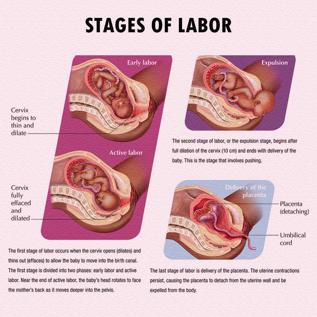 Pregnancy - 📚 Stages of Labor Facts 1️⃣ First Stage: 💥 Longest stage of ...