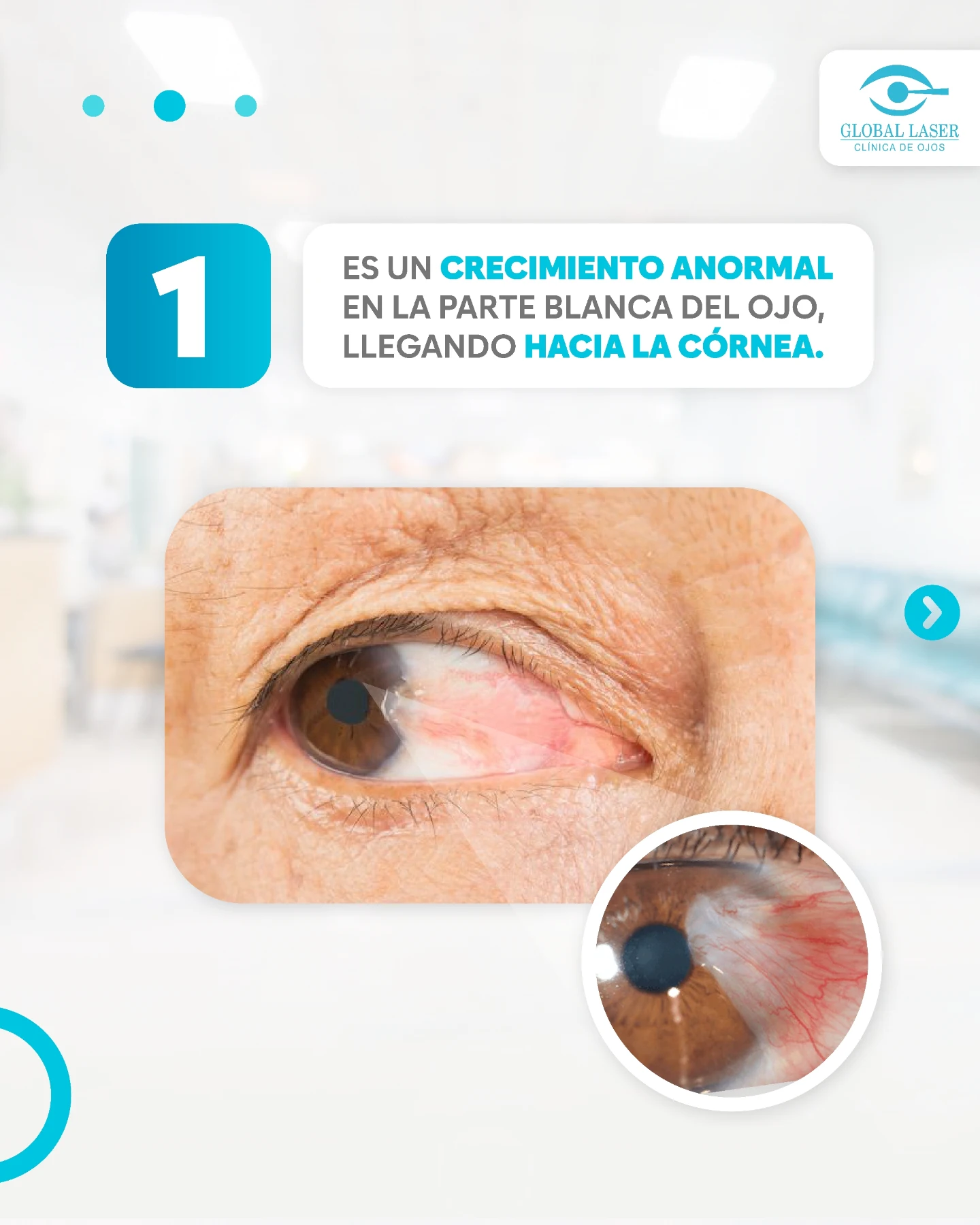 Clínica de Ojos Global Laser | Pueblo Libre