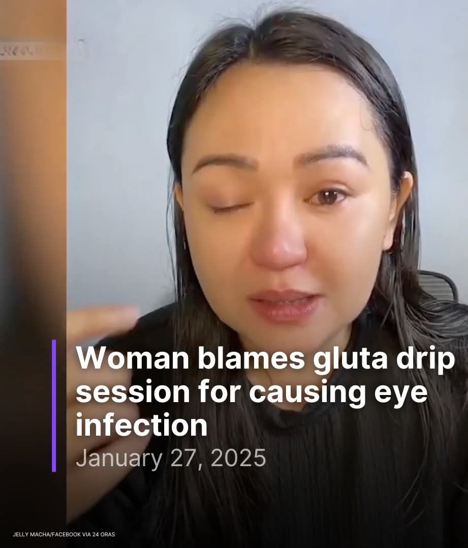 glutathione megadose eyes A social media user is raising awareness after she got an eye infection from a drip session HYDROXOCOBALAMIN INJ, USP, 1000MCG/ML, Category_The Natural Root/On Sale Size:90 Tablets - 1 Bottle