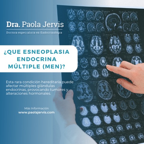 Endocrinóloga - ⚠️ ¡La neoplasia endocrina múltiple es una condición ...