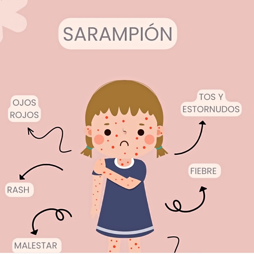 Dra - Se ha levantado una alerta epidemiológica por Sarampión en México ...
