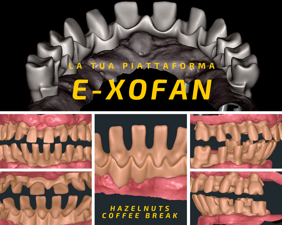 E-XOfan