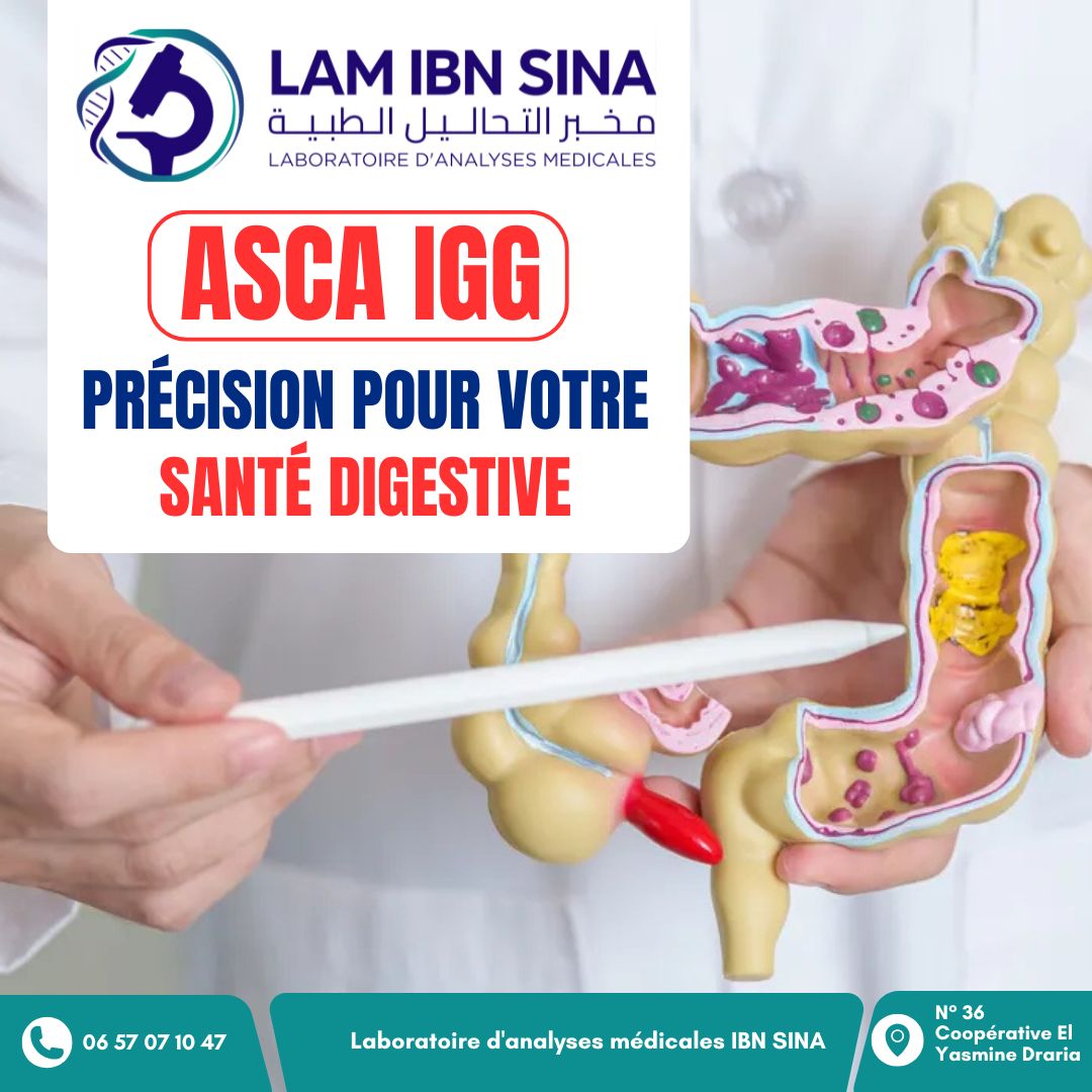 Laboratoire - L'ASCA IgG (Anticorps Anti-Saccharomyces Cerevisiae de ...