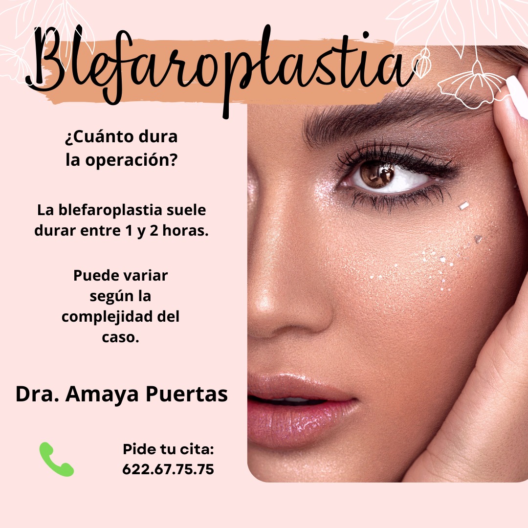 Centro - ¿Cuánto dura una operación de blefaroplastia? La ...