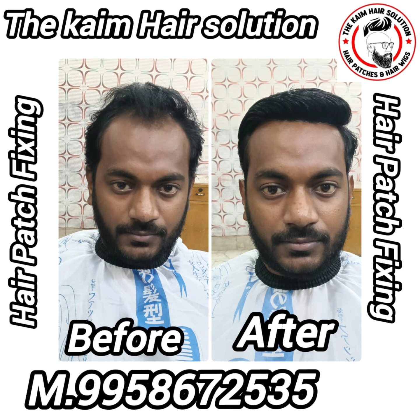 The Kaim Hair Solution