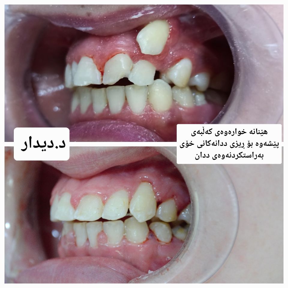دکتۆرە دیدار پزیشکی ددان - د.دیدار عبدالجبار بەکالۆریۆس لەپزیشکی ...
