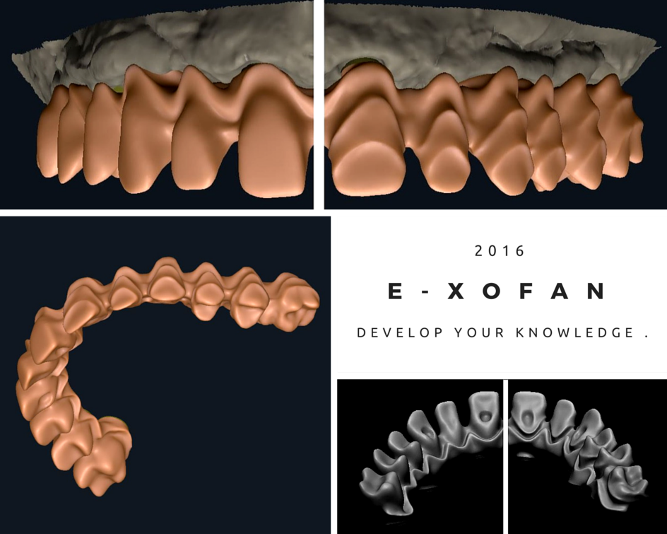 E-XOfan