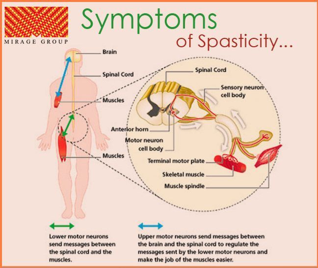 Back To Health Talk Show - Spasticity is a neurological condition ...