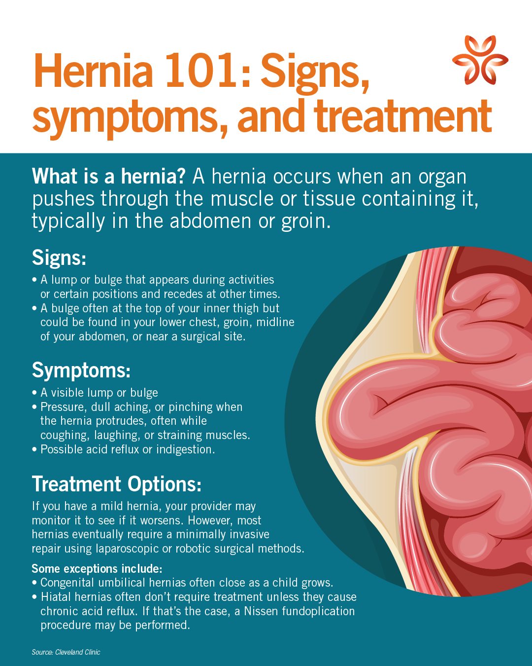 Mercy Medical Center Merced - Hernias affect millions of people every ...