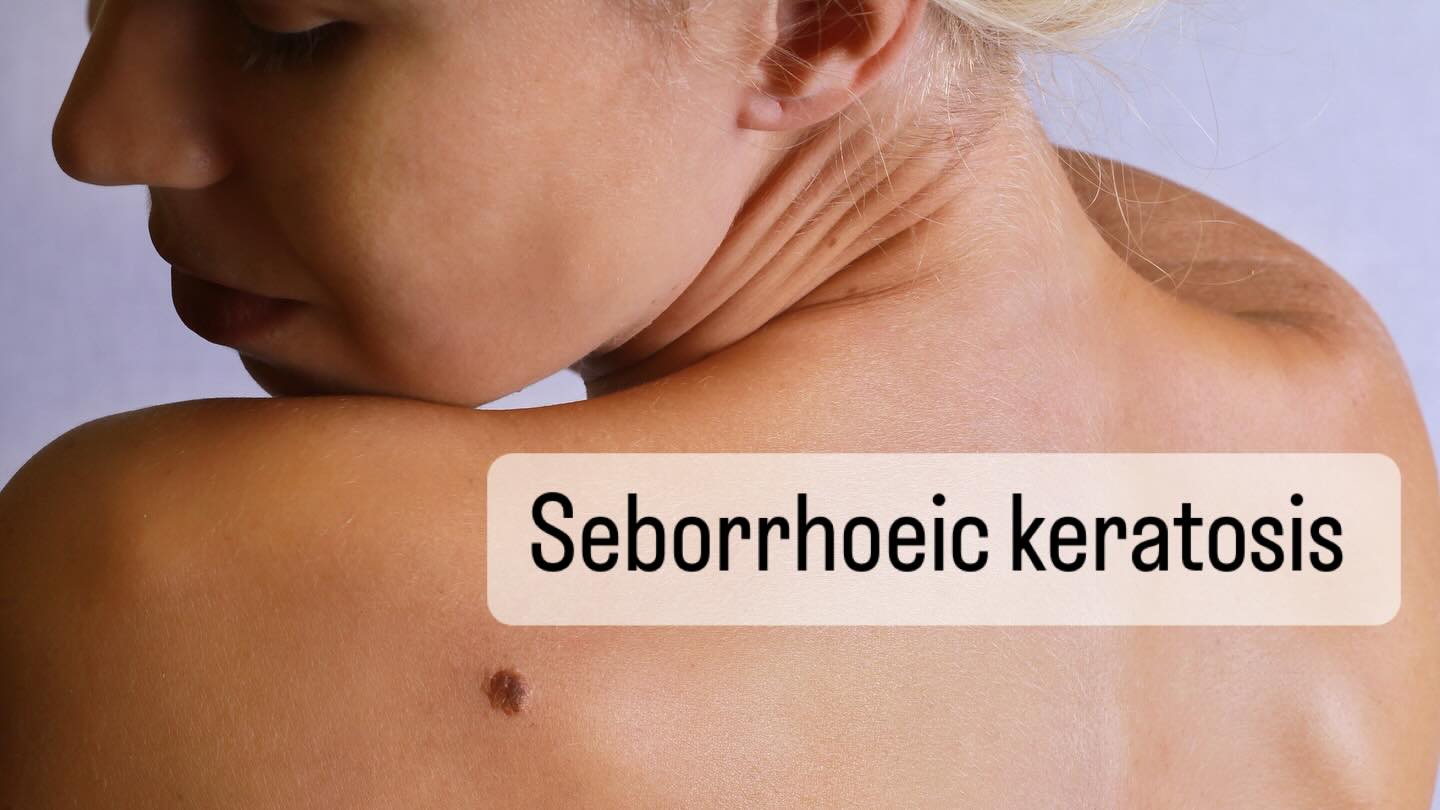 Skin - 'Seb what..?!' Is a common reaction to this terminology! So ...