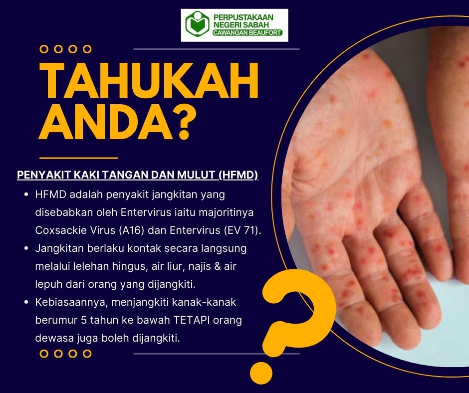 Perpustakaan - AGM Online : Tahukah anda? PENYAKIT KAKI TANGAN DAN ...