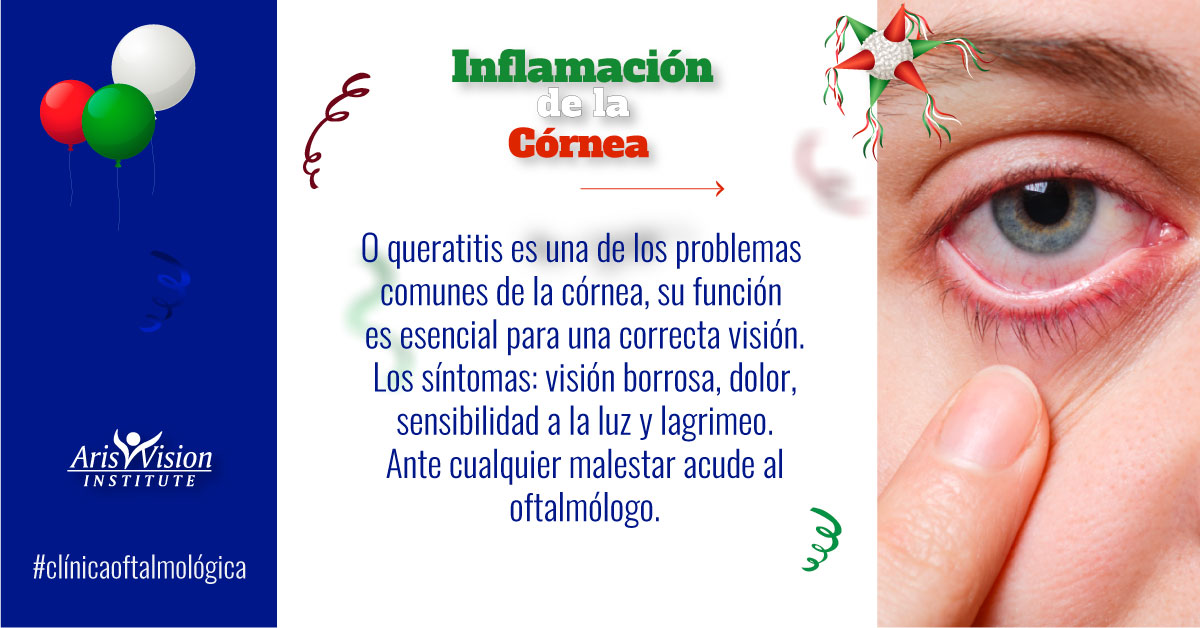 #condicionesdelosojos 👀 👉La inflamación... - Aris Vision CDMX | Facebook