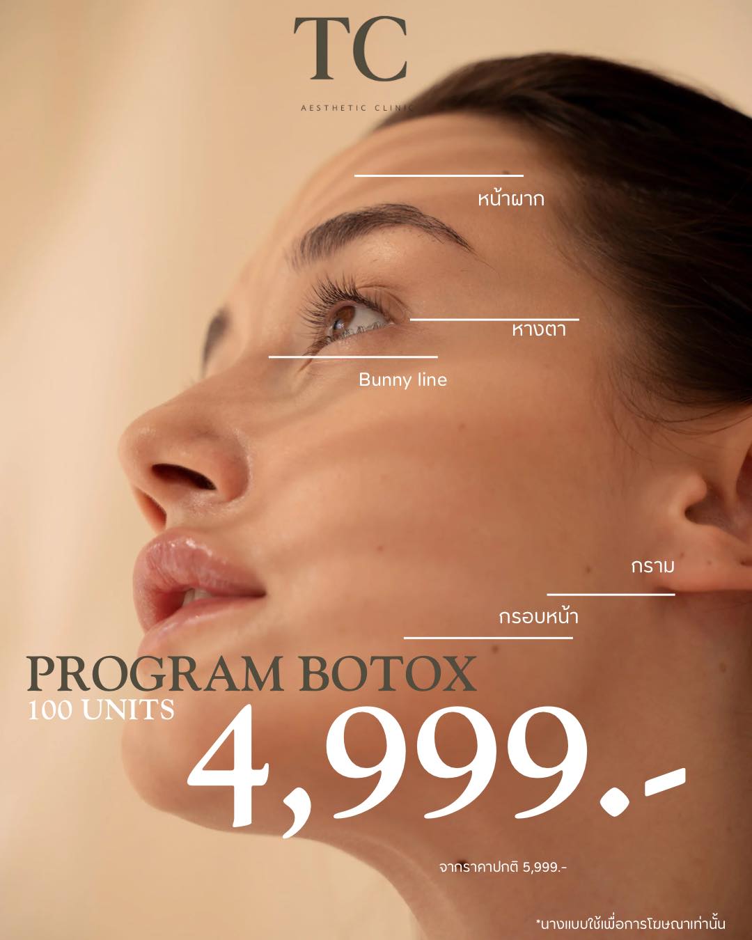 [English Below]โปรแกรมฉีดโบท็อกซ์ เลือกบริเวณจุดที่ฉีดได้ 100Units . 📣 ...