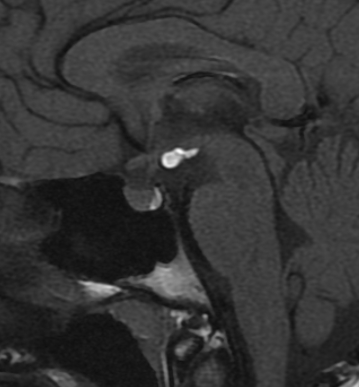 Neuroradiology - Radiopaedia.org