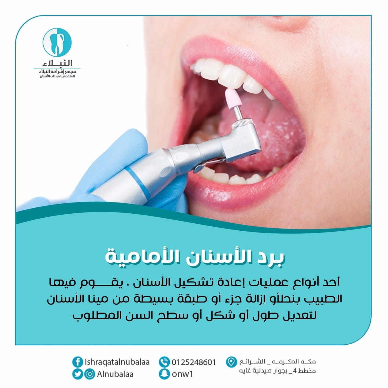 مجمع عيادات اشراقة النبلاء لطب الأسنان يمكنك تعديل شكل أسنانك من خلال بردها باحدث الوسائل العلمية والطبية لدى مجمع اشراقة النبلاء للتواصل مكة الشرائع مخطط 4 بجوار صيدلية غايه 0125248601 فيسبوك