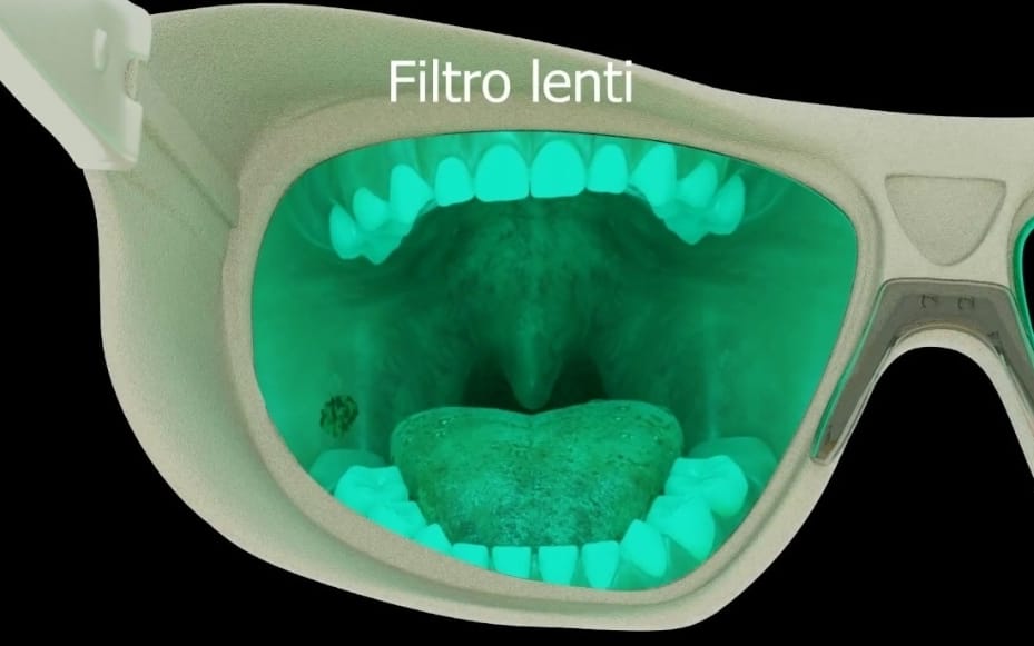 10 Archi Ausiliari Ortodontici - Coppia Radice Anteriore Inferiore/Superiore, Uso Dentistico