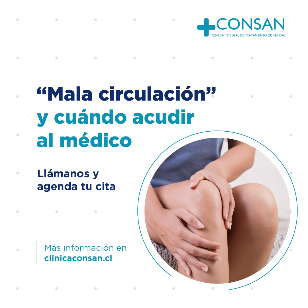 Consan - Se conoce como “mala circulación” la dificultad...