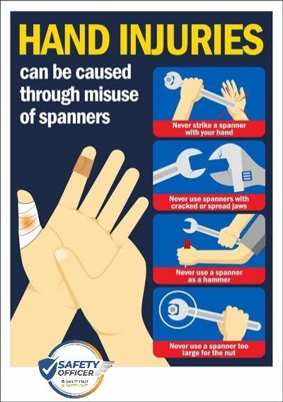SAFETY - Hand injuries SAFETY FAST safety First 🦺👍 | Facebook
