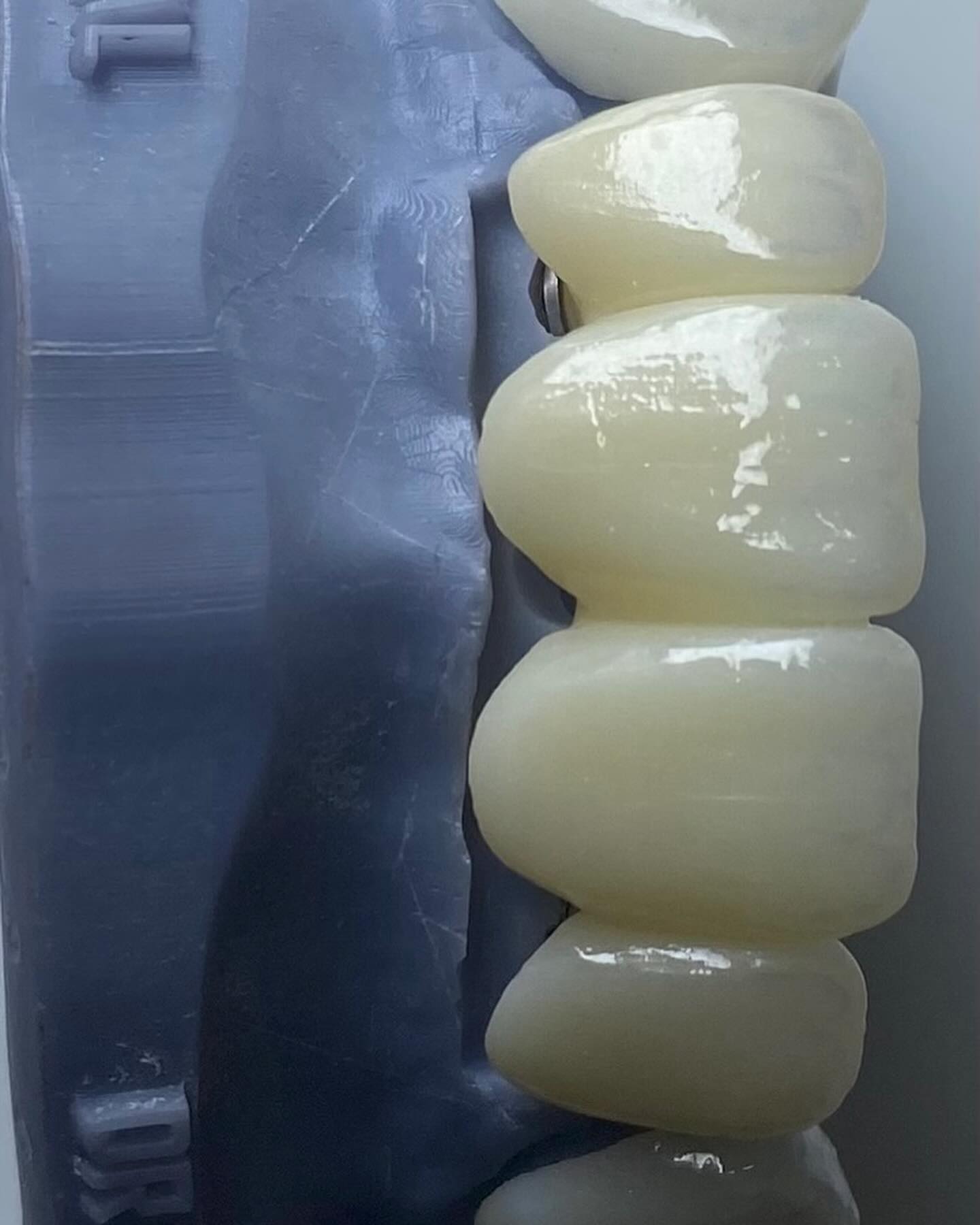 Design Digital Prótese Odontológico | Osório RS