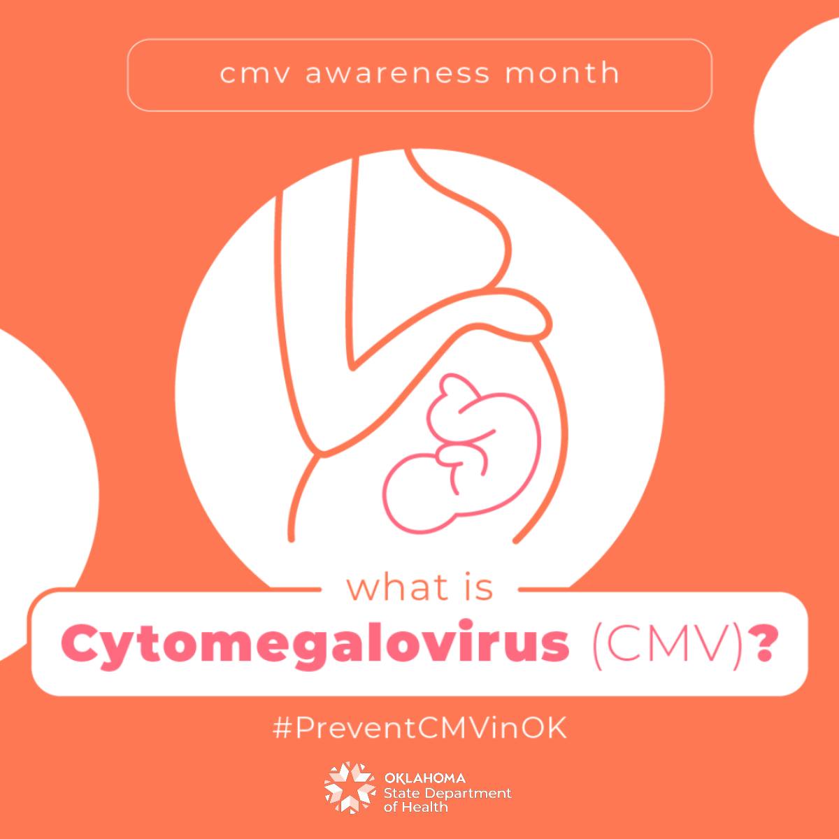 Kay - Cytomegalovirus (CMV) is a common, preventable virus that infects ...