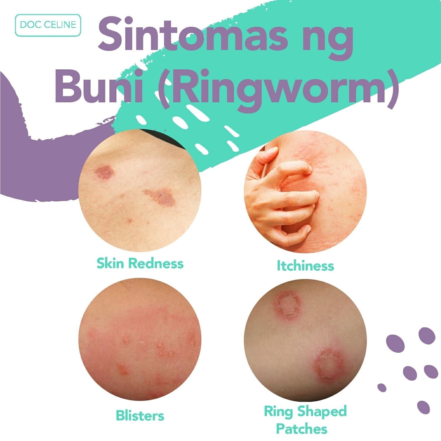 Tuwing mainit at maalinsangan ang panahon, madalas ay nagkakaroon ng ...