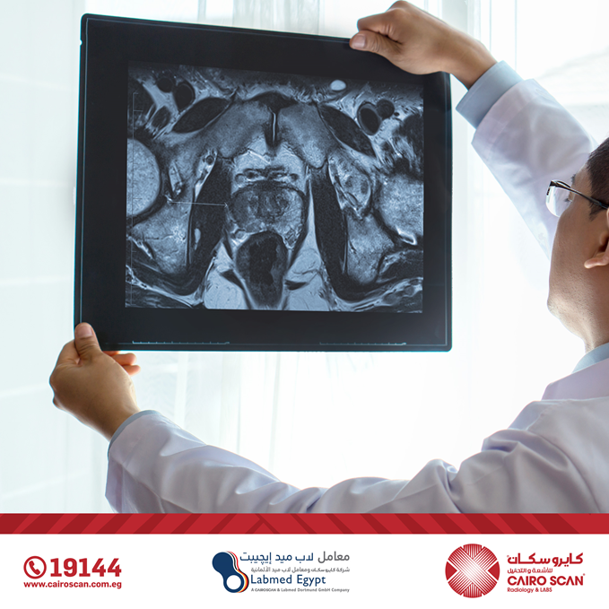 يوجد الان في كايرو سكان الرنين... - Cairo Scan Radiology&Labs