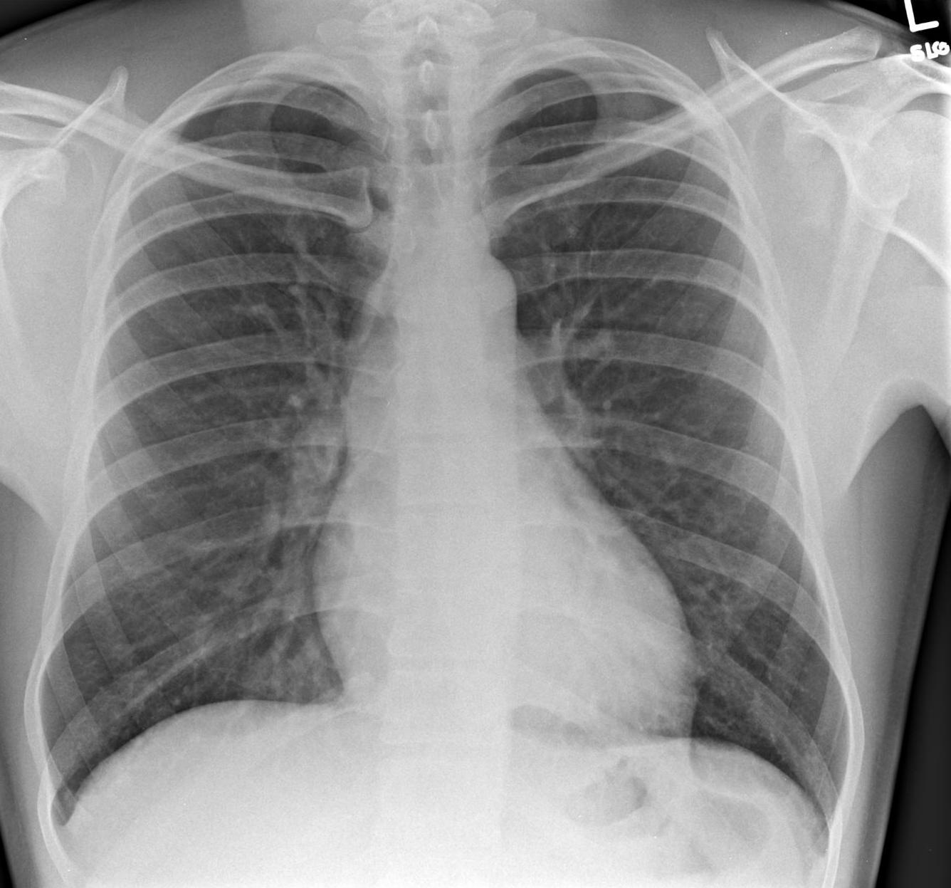European Respiratory Society
